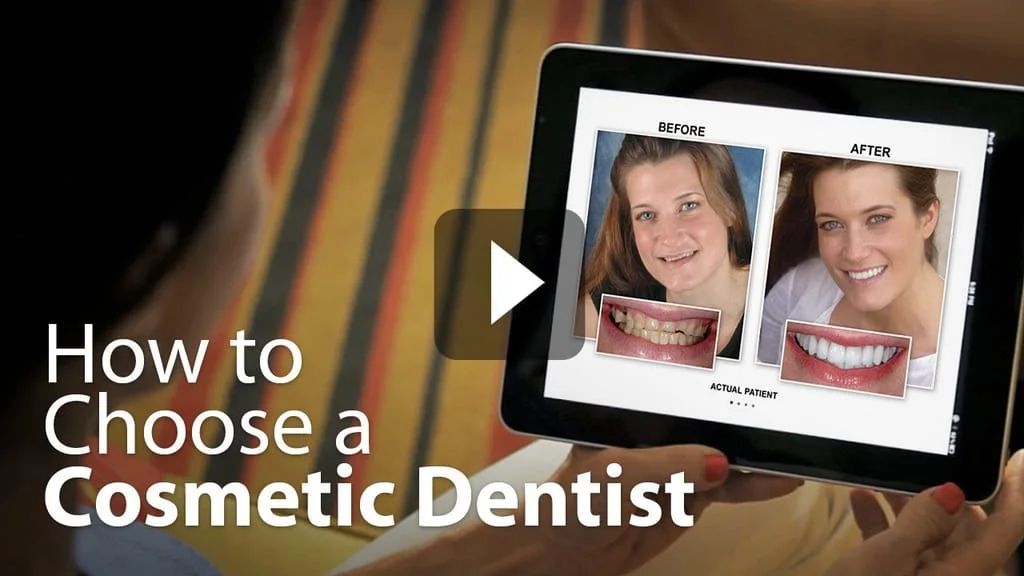 How to choose a Cosmetic Dentist