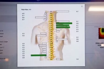 Illustration of a spine