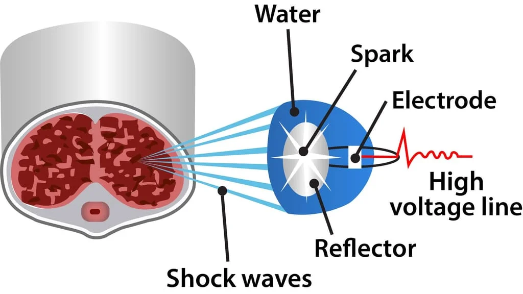 3-water-spark-wave-tissue