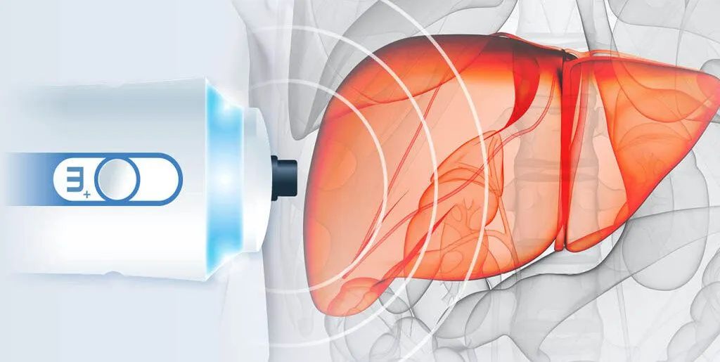 FibroScan® Procedure Prep