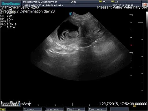 Ultrasound