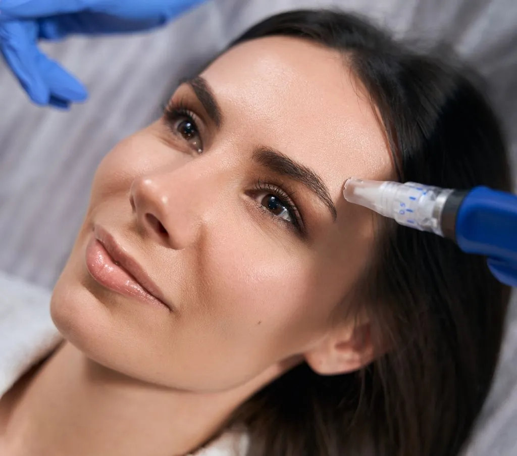 Microneedling