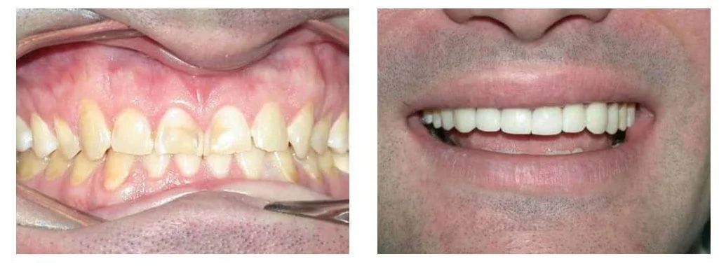 A Few Before and After Pics of Our Patients