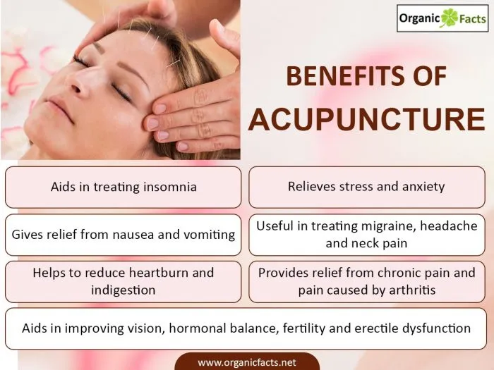 Acupuncture