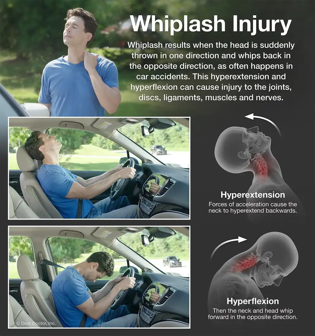 Whiplash Basalt Aspen Carbondale Spine Spot Chiropractic