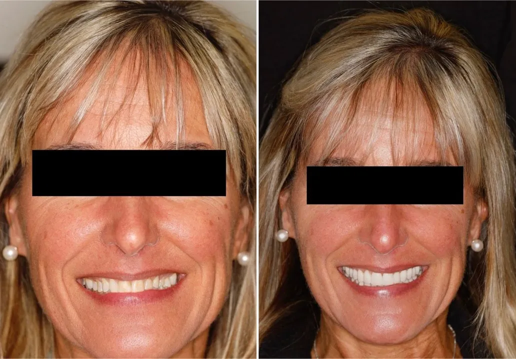 Cosmetic Dentist Brookline 