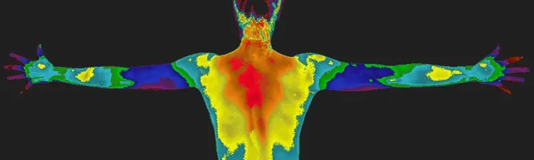 thermography