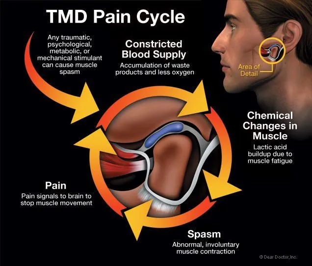Gentle, Effective Care for Jaw Pain and TMJ Disorder