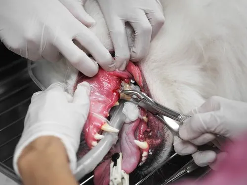 Jaw Fracture Repair FAQ