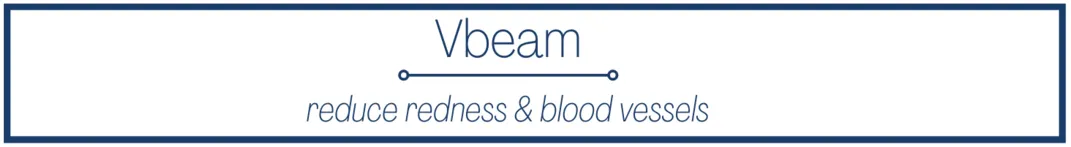 Vbeam