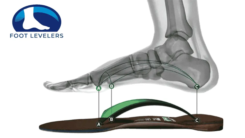 foot levelers diagram