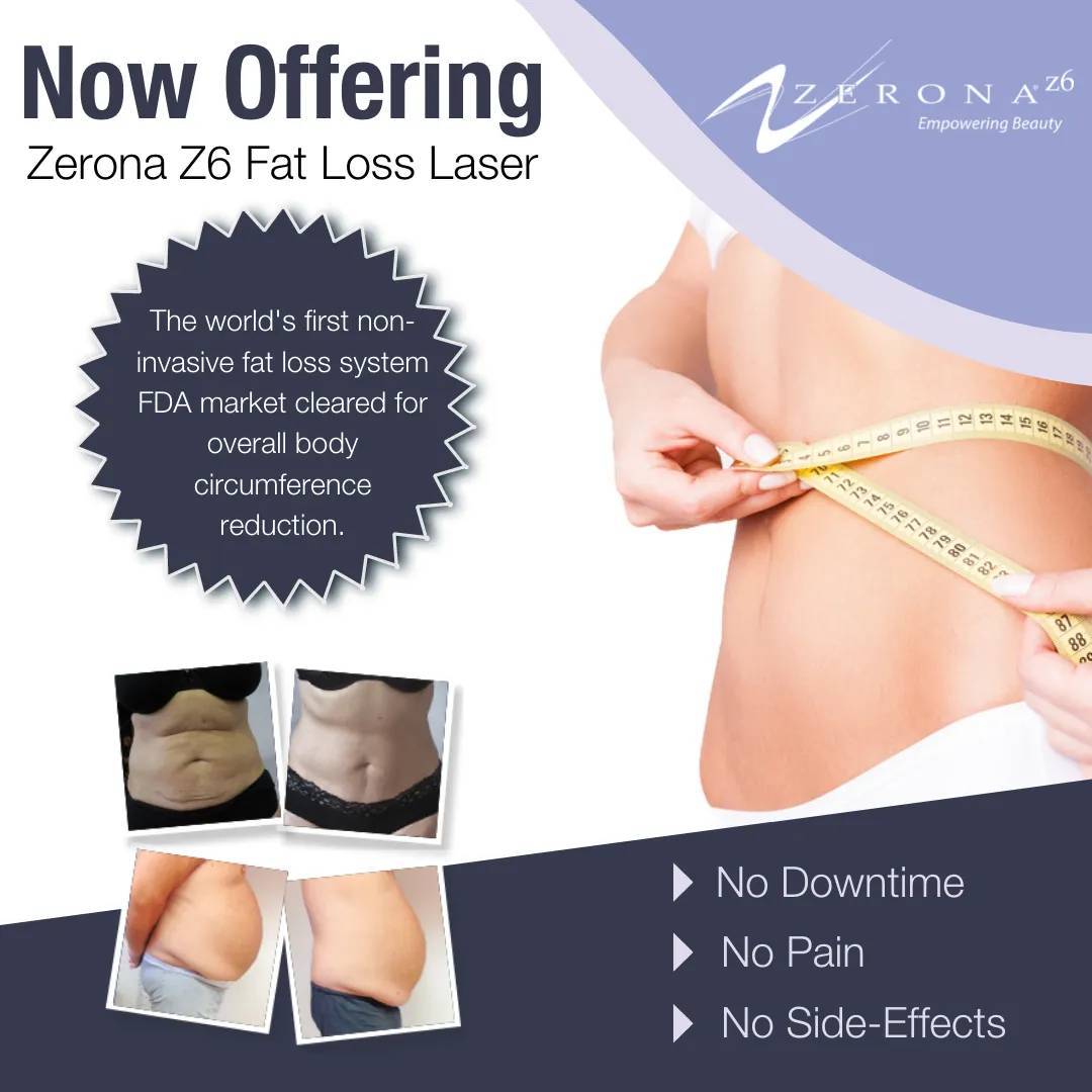 Now Offering Zerona Fat Loss Laser