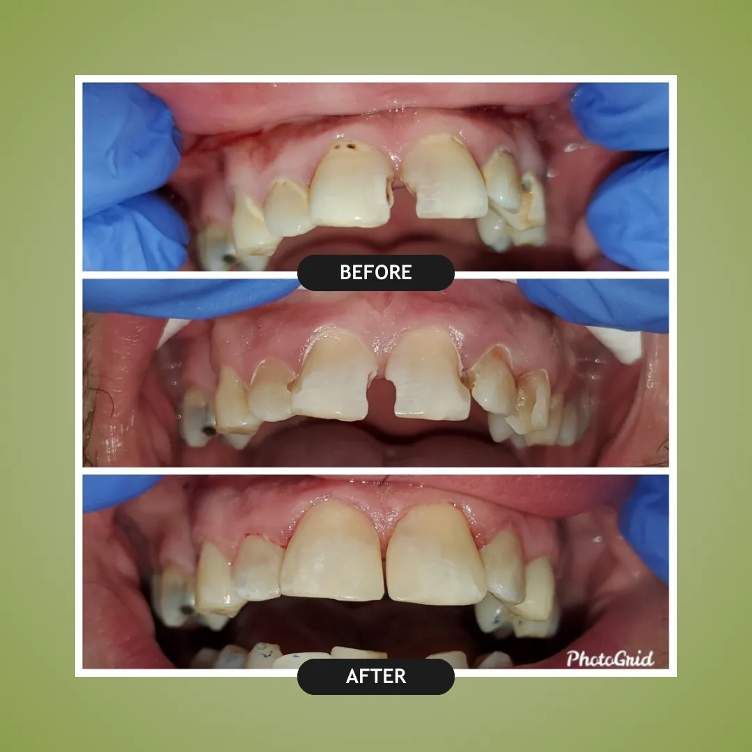 Before and After Dental Work