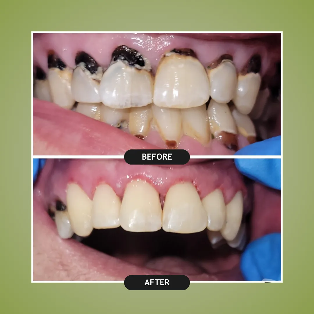 Before and After Dental Work