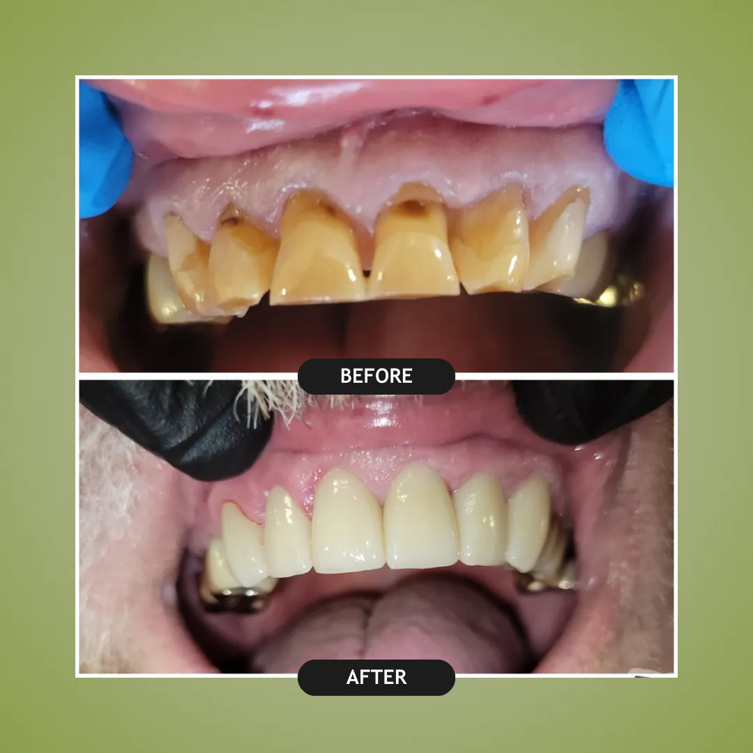 Before and After Dental Work