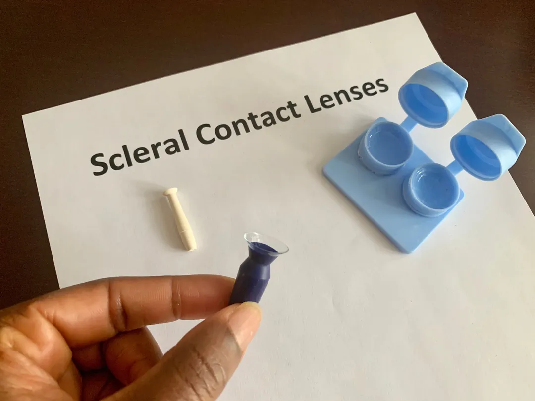 Scleral Contact Lenses