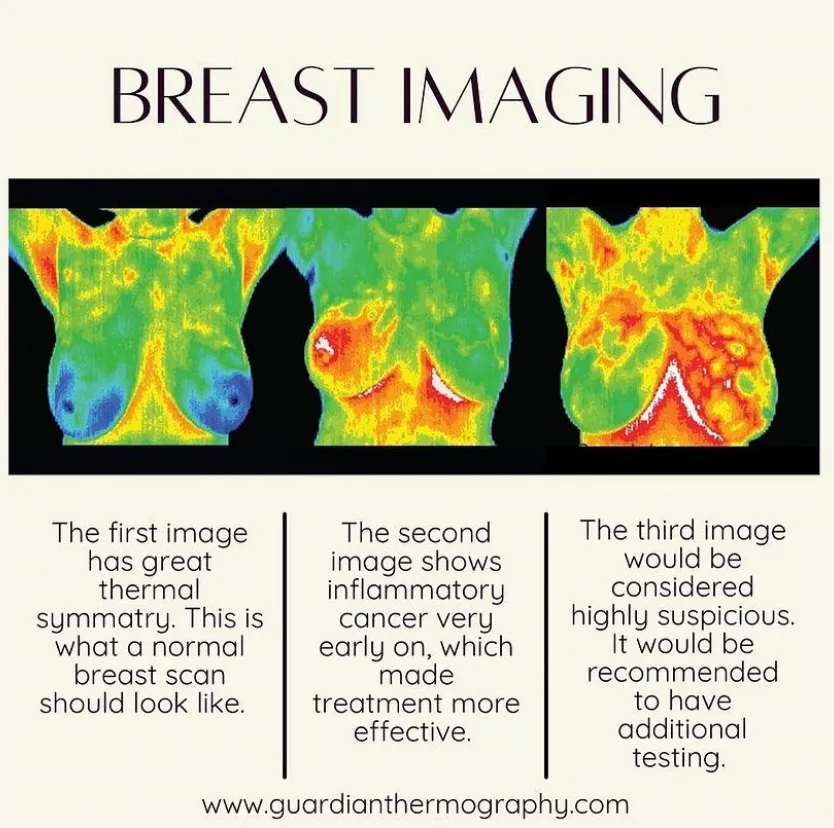 breast imaging