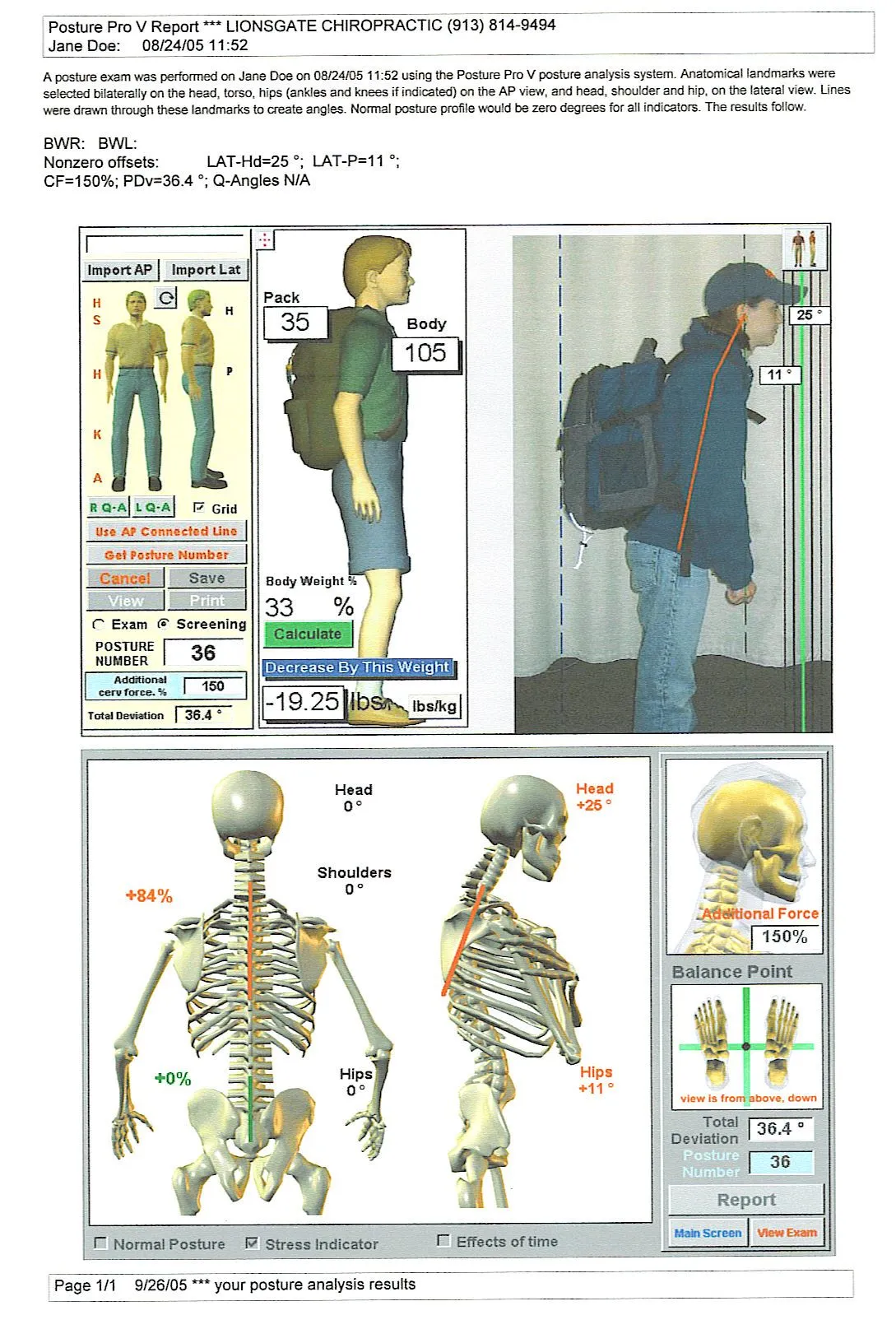 Computerized Scan Report of a Person's Bend in the Spine with a Heavy Backpack On