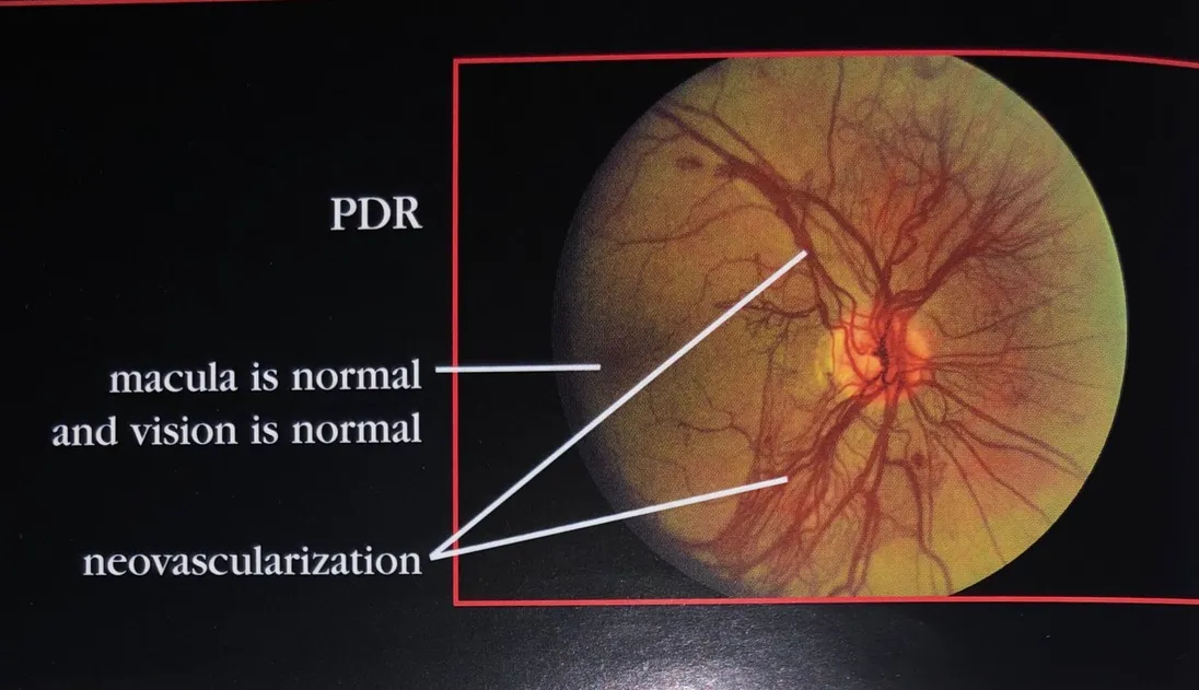 Eye diagram