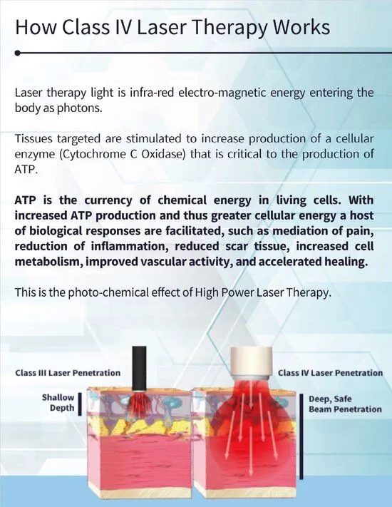 How Class IV Laser Therapy Works