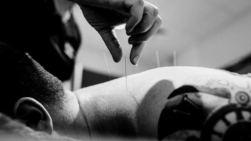 Whittier Acupuncture