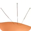 small_accupuncture_servicespage_image.png