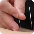 resized_110x110_acupuncture.png