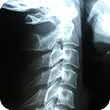 x-ray image