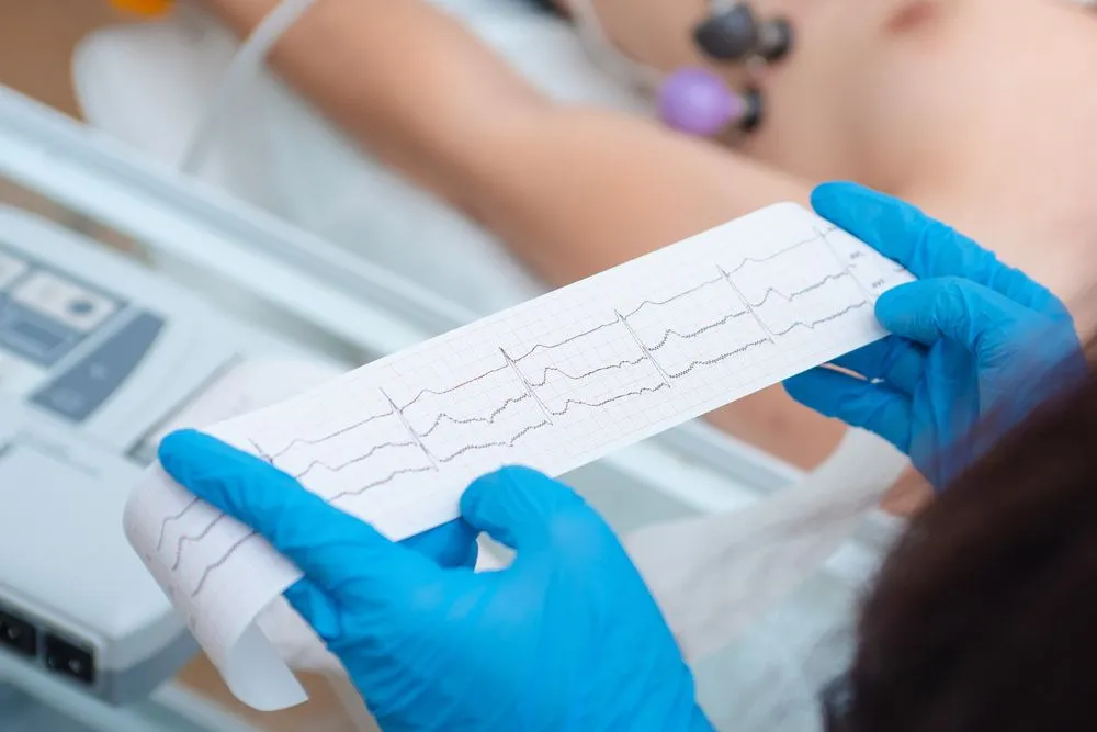 Heart cardiogram in the hands of a doctor close-up