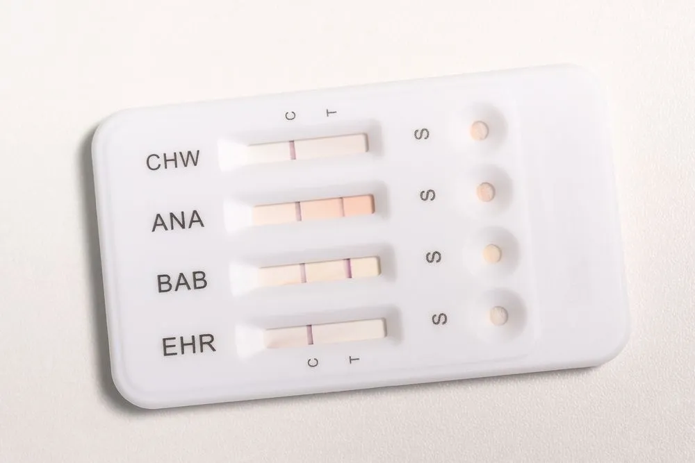The Top Benefits of Regular Heartworm Testing for Your Pet