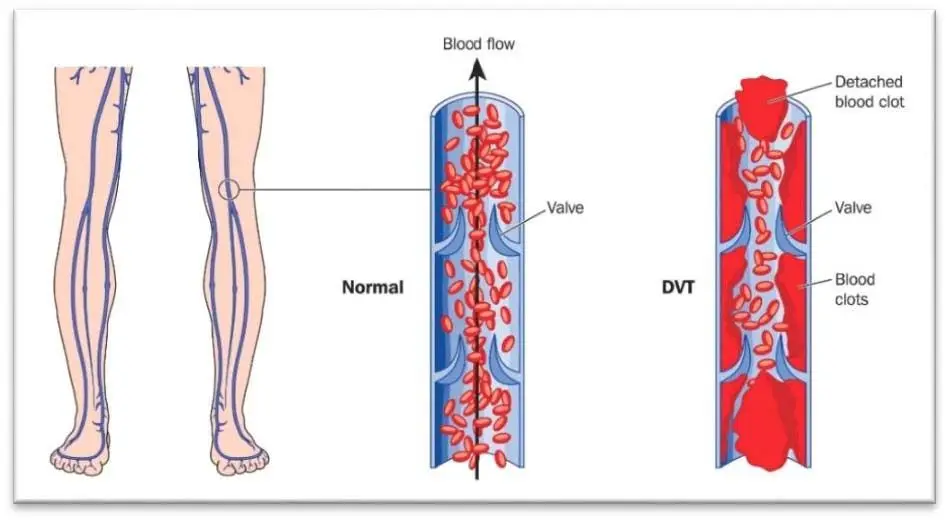 normal_vein