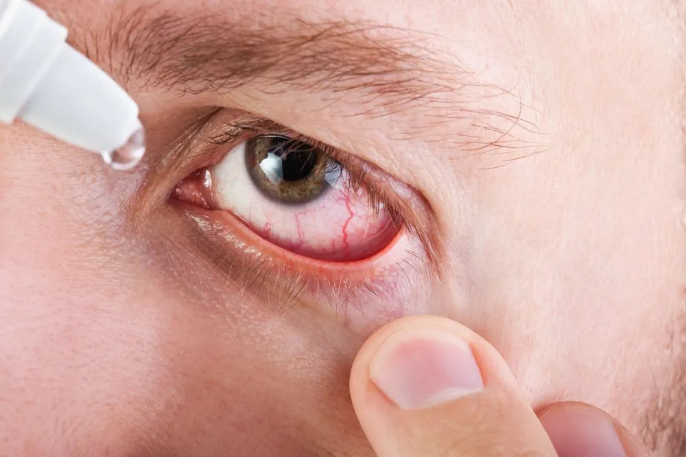 Eye Care and Aesthetic Dry eye Treatments