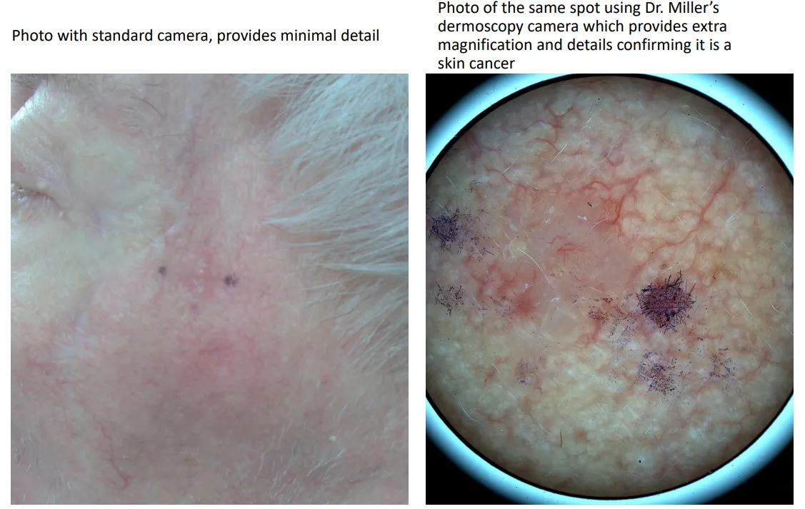 Skin Picture Example