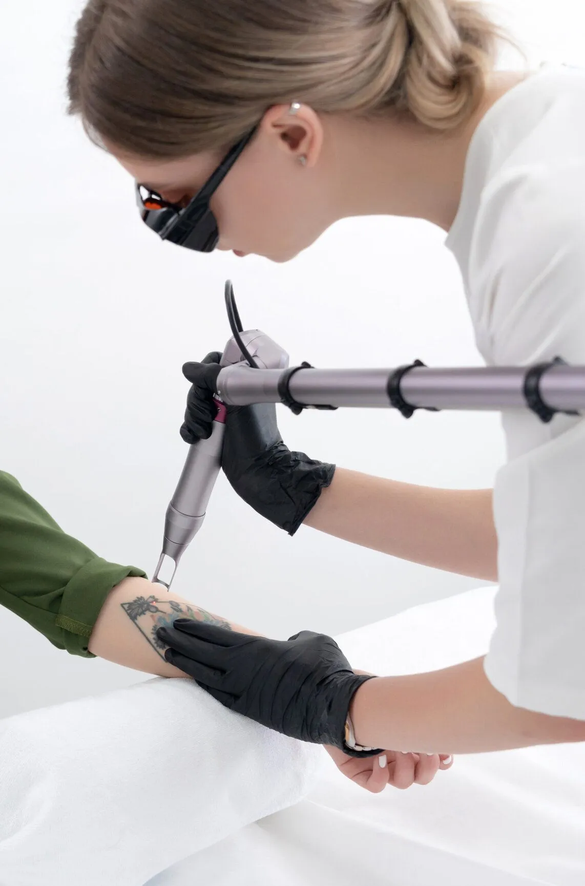 Tattoo Procedure with PicoPlus