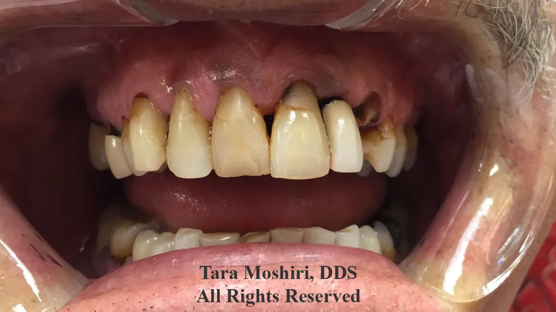 Artiste Dentistry LLC: Tara Moshiri, DDS