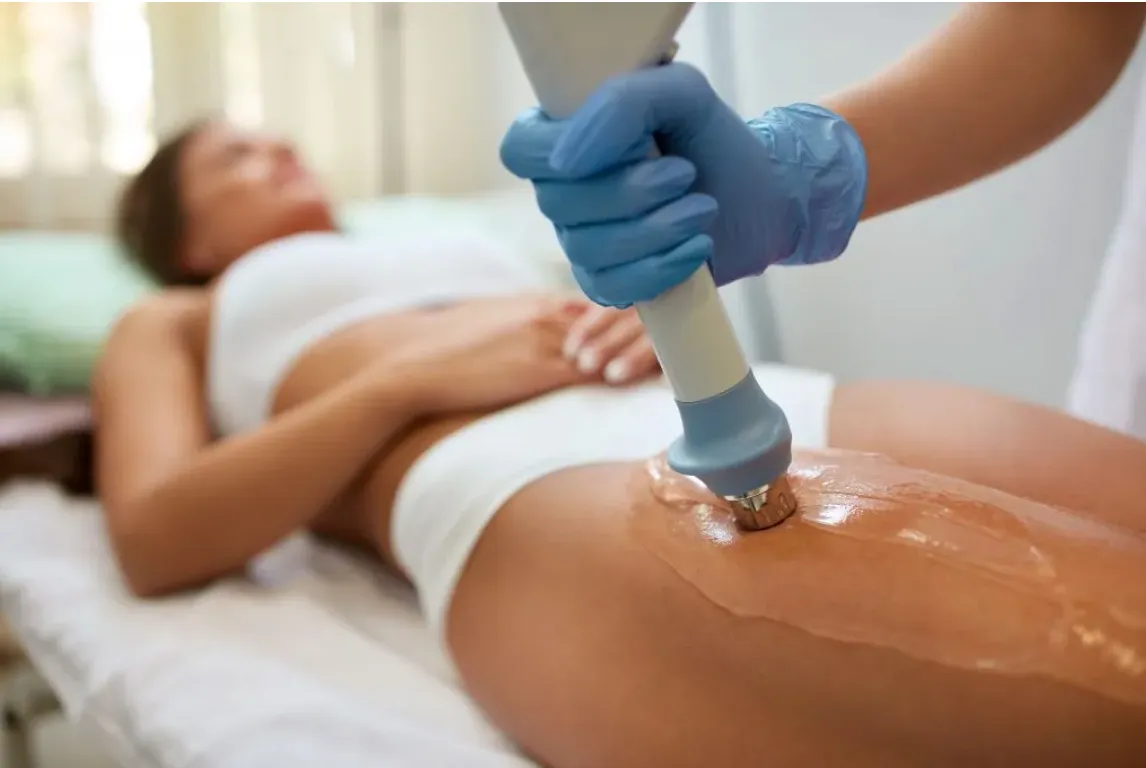 cellutone cellulite treatment in winter park, florida