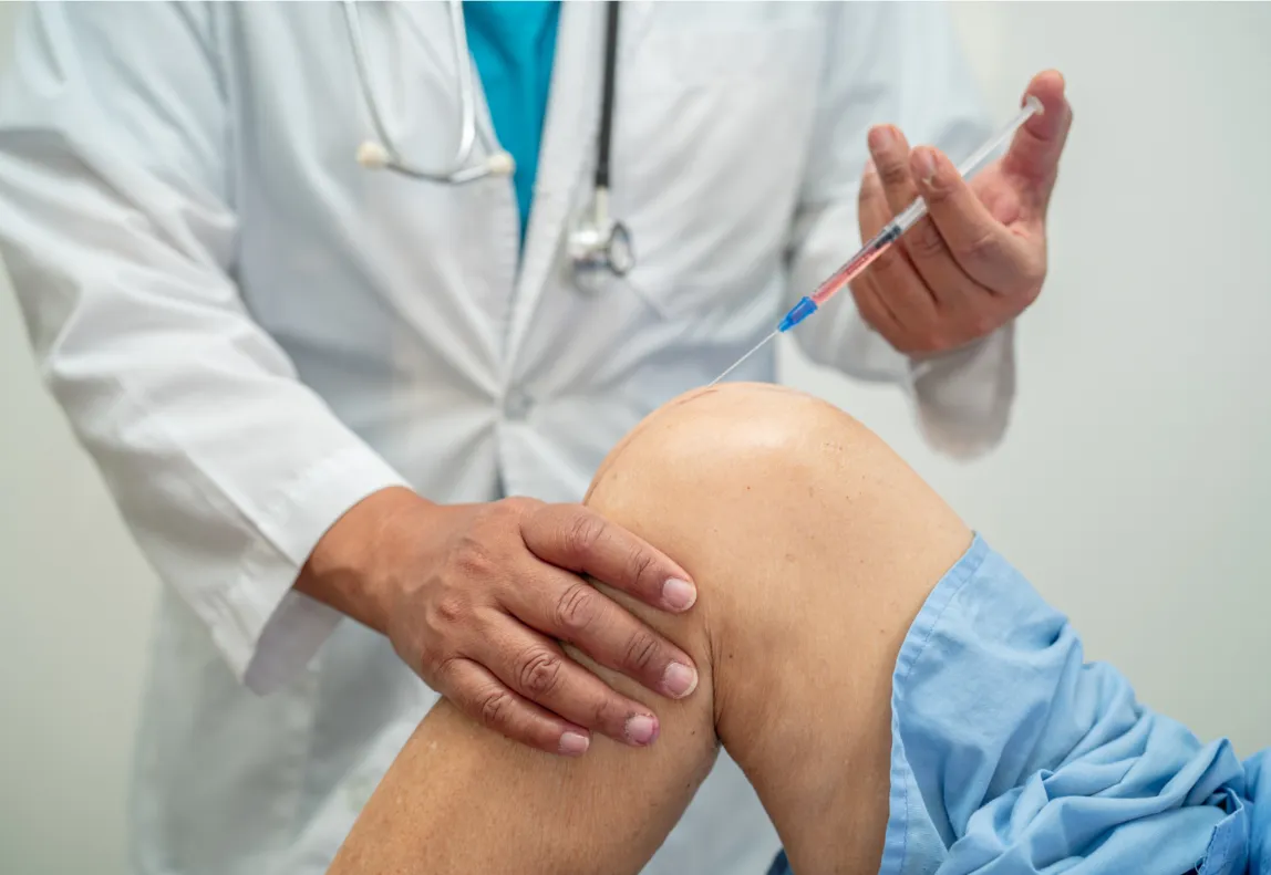 prp knee 