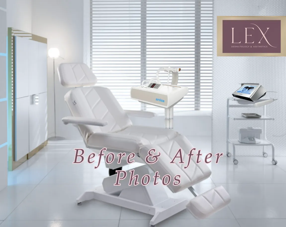 Before & After Photos