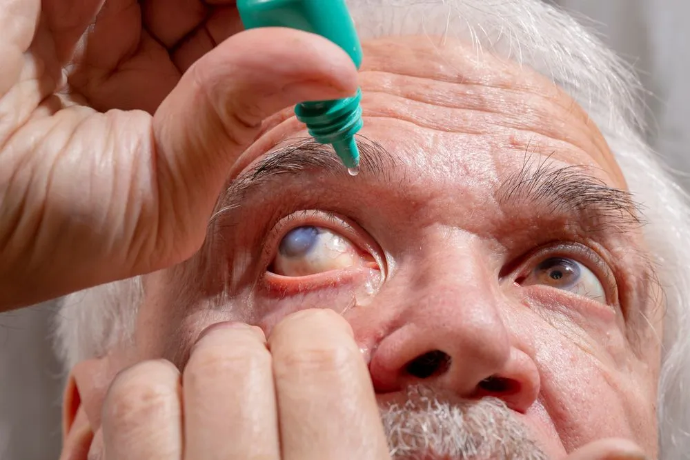Glaucoma Treatment