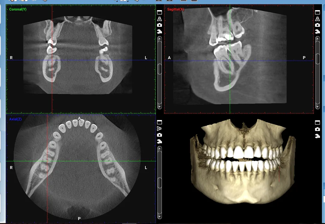 CBCT Sample