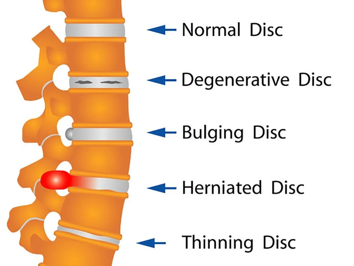 Spine