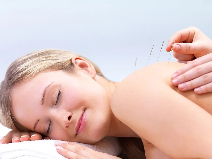 woman enjoying acupuncture