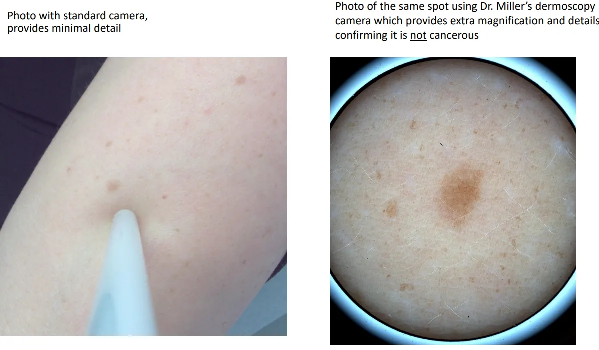 Skin Picture Example