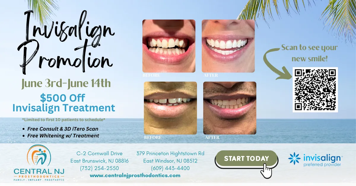 Invisalign summer promotion