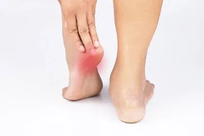 Helping You Manage Your Heel Pain