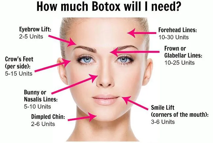 How much botox will i need?