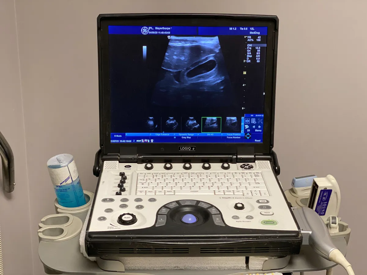 Ultrasound