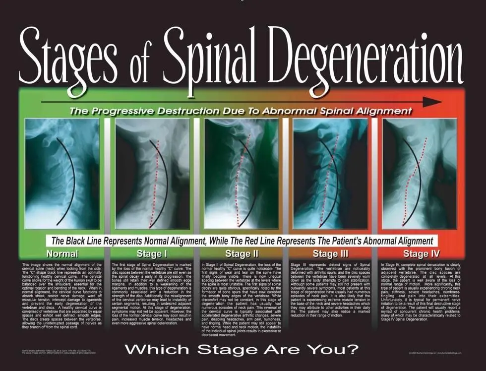 degeneration