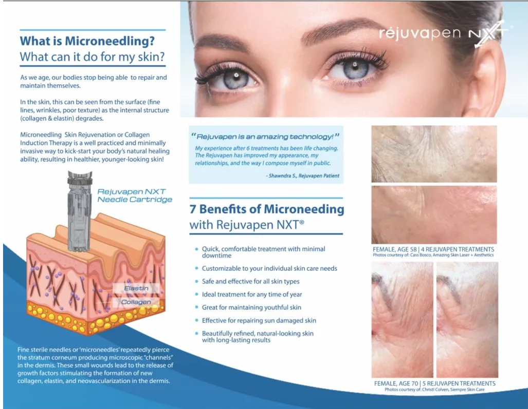 microneedling