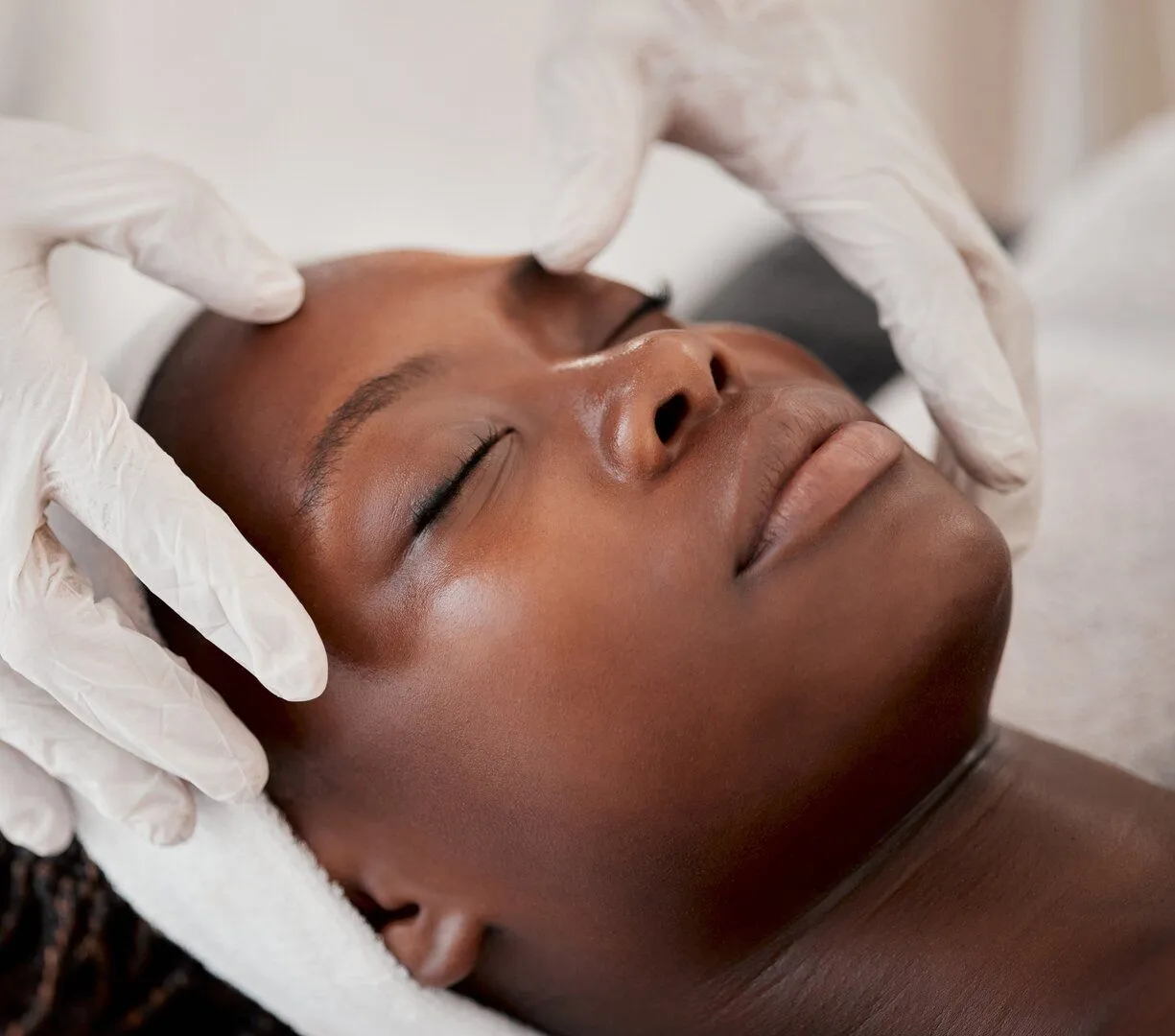 Medical Grade Chemical Peels
